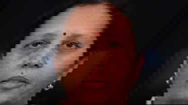 Dental patient testimonial after dental treatment -3